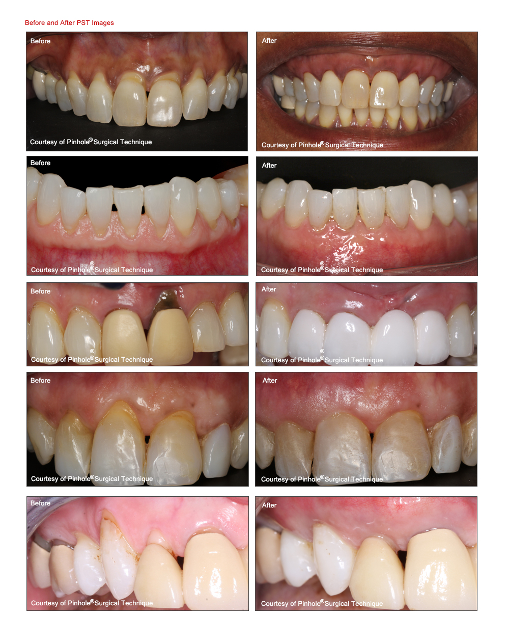 before and after